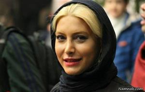     چهره متفاوت  و عجیب  خانم بازیگر ایرانی پیش از عمل زیبایی  + عکس