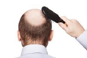 یک روش جدید برای جلوگیری از ریزش و پرپشت کردن مو+دستورالعمل
