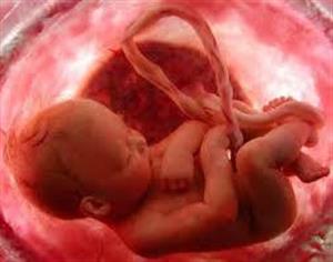 استامینوفن باعث سقط جنین می شود 
