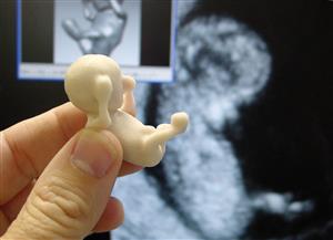 سونوگرافی بارداری برای راحتی مادر است