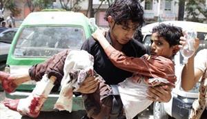 کشته و زخمی شدن ۱۰۳۰۰ زن و کودک یمنی از آغاز حمله عربستان
