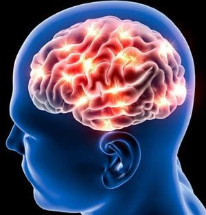 درمان سکته مغزی برای کدام بیمارستان‌ها اجباری است؟