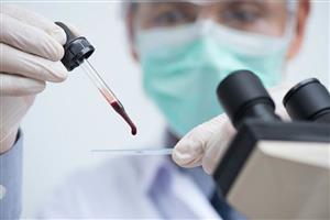 شناسایی آنتی بادی جدید برای جلوگیری از لخته شدن غیرطبیعی خون