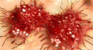 سلول های ضد پیری؛ مفید در مقابله با گسترش سرطان