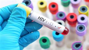 ویروس شبه HIV از ژنوم پستانداران ویرایش شده است