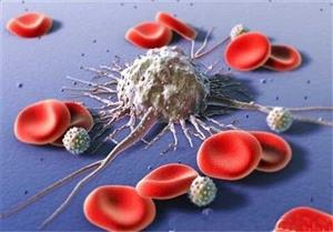 داروی جدید برای مقابله با سرطان خون پرخطر