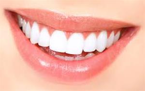 چرا دندان هایمان زرد می شود؟/چه کنیم دندان ها سفید شود؟
