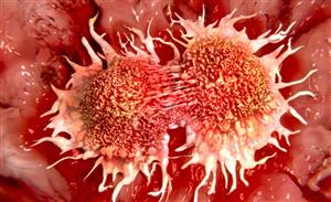 سرطان مثانه بدون توجه به جهش ژنی به ایمنی درمانی پاسخ می دهد