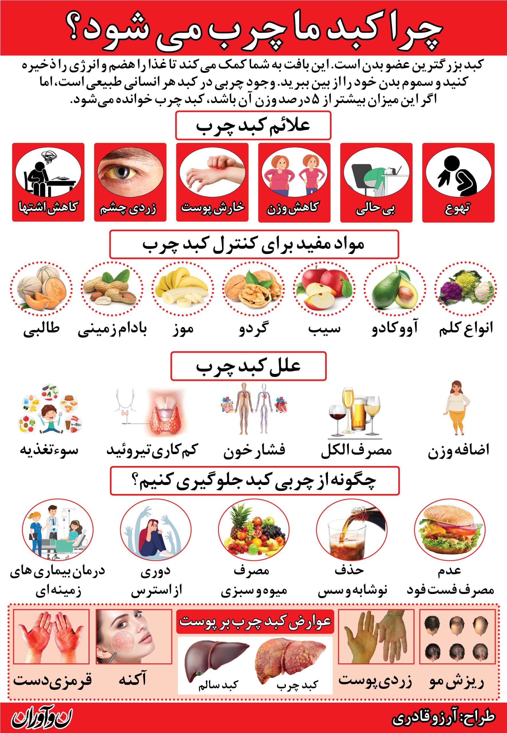کبد چرب